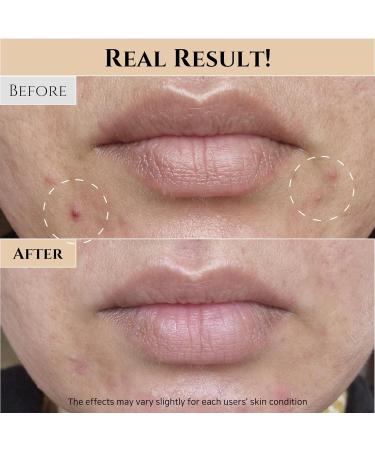 Buy Beauty of Joseon Glow Replenishing Rice Toner - 150ml for Oily & Combination Skin | Korean Moisturizing Care - International Shipping Available - Buy Online on GoSupps.com