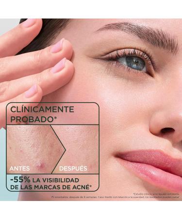 L'Or al Espa a SA GARNIER Pure Active Salicylic Acid AntiBlemish Exfoliating Liquid Reduces Pore Visibility by 34 Suitable for Sensitive Skin 120ml - Buy Online on GoSupps.com