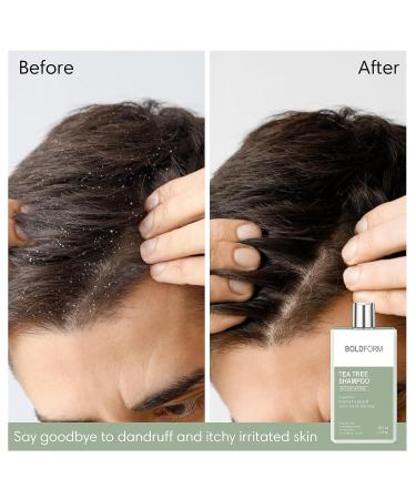 Color Safe Tea Tree Shampoo with Peppermint Oil - Deep Cleanser for Dandruff & Itchy Scalp 10.1 oz | Hair Regrowth for All Hair Types - Buy Online on GoSupps.com