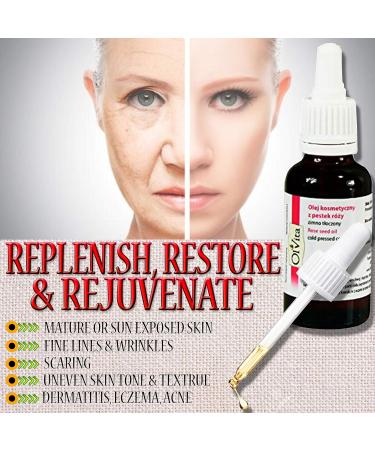 Ol Vita: Rosehip Seed Oil Virgin Cold Pressed - 100% Pure Natural Moisturiser for flawless skin 30 ml - Buy Online on GoSupps.com