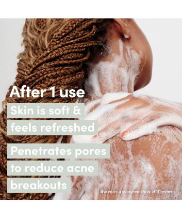 Dove Serum Body Wash Acne Clear for troubled skin with Salicylic Acid 18.5 Fl Oz 18.5 Fl Oz (Pack of 1) - Buy Online on GoSupps.com