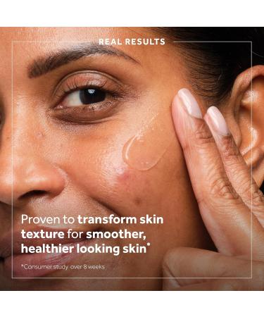 No7 Derm Solutions AHA Exfoliant & Face Toner with Lactic & Glycolic Acid - AHA Smoothing Treatment - Controls Oil and Minimizes Pores - for Oily & Blemish-Prone Skin (1 Fl Oz) - Buy Online on GoSupps.com