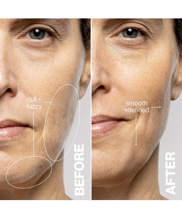 DERMAFLASH LUXE Device: Anti-Aging Exfoliation, Hair Removal, Dermaplaning Tool with Sonic Edge Technology - Blush LUXE + 4 Weeks Treatment - Buy Online on GoSupps.com