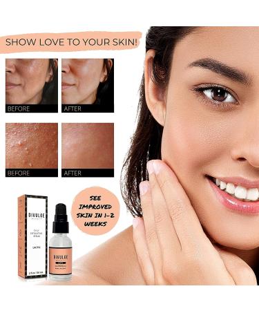 AHA 10% Lactic Acid Daily Exfoliating Serum 1 oz - Clear Pigmentation, Sun Damage, Acne - Divulge Beauty - Buy Online on GoSupps.com