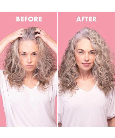 Umberto Giannini Scalp Rescue Anti Dandruff Hair and Scalp Mask - Vegan & Cruelty Free - 150ml - Buy Online on GoSupps.com