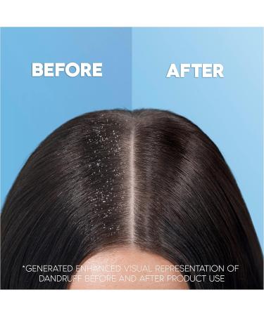  Head & Shoulders Head & Shoulders Apple Fresh 2-in-1 Shampoo anti-dandruff shampoo and conditioner 450 ml - Buy Online on GoSupps.com