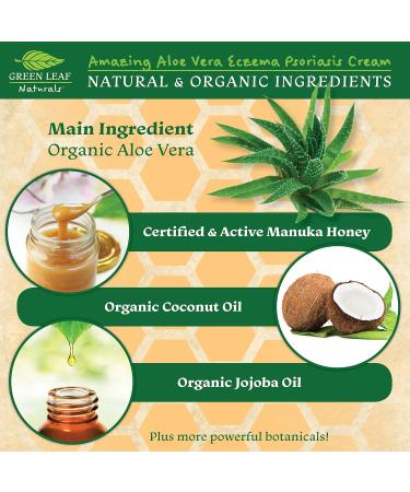 Manuka Honey Eczema Cream - 4oz Moisturizing Lotion for Psoriasis Relief & Itchy Dry Skin - Healing Ointment for Kids, Adults & Babies - Buy Online on GoSupps.com