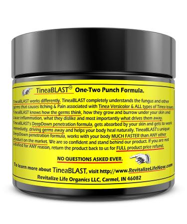 Best Tinea Versicolor Treatment Cream: Fast Relief for Tinea Pedia, Cruris, Capitis, and Corporis - Natural and Effective Solution - Buy Online on GoSupps.com