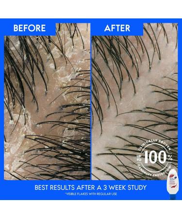 Head and Shoulders Smooth and Silky Conditioner - Fights Dandruff Smooths Frizzy Hair 1.7 oz (Pack of 6) - International Shipping Available - Buy Online on GoSupps.com