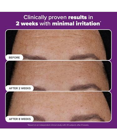 Paula s Choice Pro Retinaldehyde Dual-Retinoid Face Serum Advanced Treatment High Potency Anti-Aging Serum for Face Breakout-Prone Skin Radiance & Rough Bumpy Texture Fragrance-Free Full Size - 1 Fl Oz - Buy Online on GoSupps.com