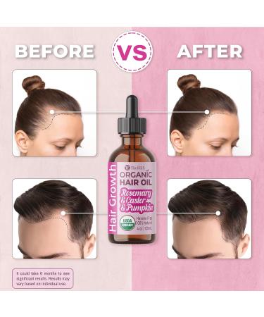 USDA Organic Rosemary Hair Oil for Hair Growth | Cold Pressed Castor & Pumpkin Seed Oil Blend - Thickening Treatment for Women & Men | 4oz - Buy Online on GoSupps.com