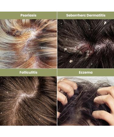 ABERA Alan Silver Serum Botanical Hydration for Sensitive Dry or Flaky Skin Plant-Based Face & Body Moisturizer with Black Ginger Neem Leaf & Cedar Oil 25ml 1 Box - Buy Online on GoSupps.com