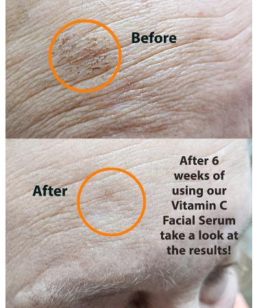 VITAMIN C Serum 1 oz. Anti-Aging Skin Brightener with Hyaluronic Acid and Collagen Boosting Peptides