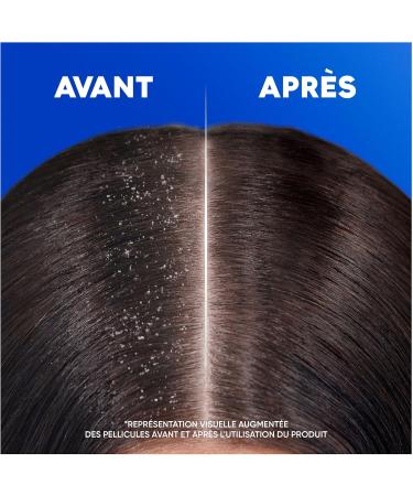 Head & Shoulders Classic Anti-Dandruff Shampoo 6x330ml Daily Use Clinically Proven to Eliminate Dandruff Up to 100% All Hair and Scalp Types - Buy Online on GoSupps.com