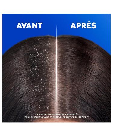 Head & Shoulders Classic Anti-Dandruff Shampoo 330ml Daily Use Up to 100% Dandruff Removal Clinically Proven All Hair and Scalp Types - Buy Online on GoSupps.com