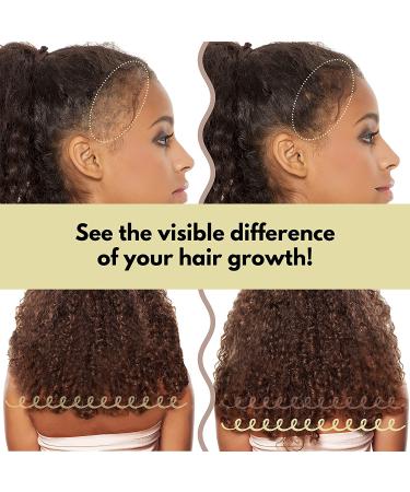 Organic Rice Water Hair Growth DIY Kit with Spray Bottle - Deep Conditioner for Damaged, Dry, Frizzy, Curly Hair - Buy Online on GoSupps.com