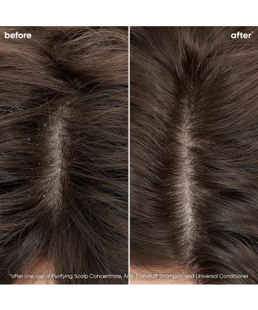 Biolage Scalp Sync Anti-Dandruff Shampoo Controls the Appearance of Flakes & Relieves Scalp Irritation 13.5 Fl Oz - Buy Online on GoSupps.com