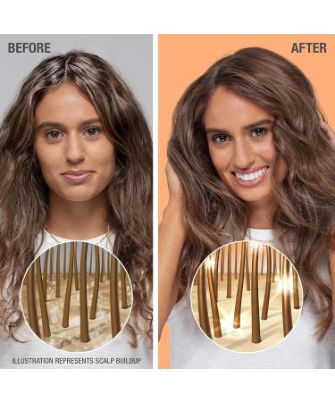 Neutrogena Exfoliating Healthy Scalp Clarify & Shine Shampoo for Oily Hair and Scalp Anti-Residue Shampoo with Pink Grapefruit pH-Balanced Paraben & Phthalate-Free Color-Safe 354 ml. Shampoo Pink - Buy Online on GoSupps.com