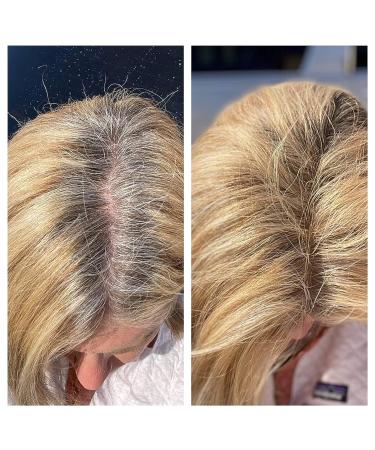 Rootflage Instant Blonde Root Touch Up Hair Powder - Temporary Hair Color Concealer for Thinning Hair (Warm Blonde) - 25 Shades Available - Buy Online on GoSupps.com