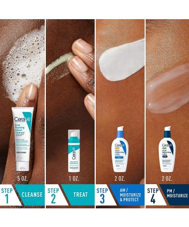 CeraVe Acne Skin Care Set - Benzoyl Peroxide Face Wash, Retinol Serum, SPF AM Moisturizer, PM Moisturizer | 5oz Cleanser + 1oz Serum + 2oz AM Lotion + 2oz PM Lotion - Buy Online on GoSupps.com