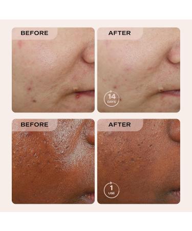 Erno Laszlo Detox Double Cleanse Duo Cleansing Oil and Sea Mud Deep Cleansing Bar for Oily and Combination Skin 6.4 fl oz / 3.4 oz - Buy Online on GoSupps.com