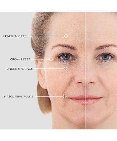 Instant Lifting Serum - Hydrating Face & Eye Contour with Hyaluronic Acid & Peptides - 15ml - Global Shipping Available - Buy Online on GoSupps.com