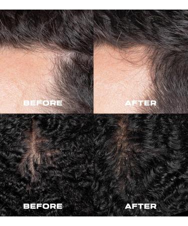 XMONDO Hair A3 Complex Scalp Foam for Hair Density | Vegan Formula with Biollagen & Amaranth Fast-Acting Plant Actives For Amplified Volume & Visibly Fuller Healthier-Looking Hair 3.38 Fl Oz - Buy Online on GoSupps.com