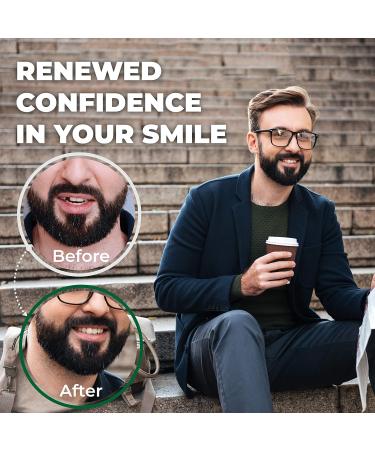 Temporary Tooth Kit 3 Pack Extra Dental Replacement, 25% More Than Competitors - Buy Online on GoSupps.com
