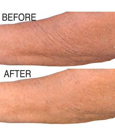 PH Factor 5.5 Clinical Retinol Moisture Cream for Face, Body & Hands - Anti Aging & Wrinkle Cream - 16 Fl Oz - Made in USA - Buy Online on GoSupps.com