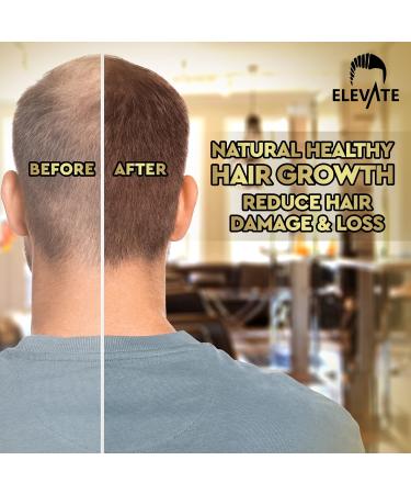 ELEVATE Hair Growth Oil - Biotin & Castor Oil Serum for Stronger, Thicker Hair Growth - Prevents Loss & Thinning - Men & Women - 2 Fl Oz - Buy Online on GoSupps.com