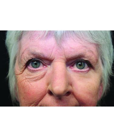 Rox Flawless Eyes by RX | Premium Eye Care for Radiant Skin | Shop Internationally Now - Buy Online on GoSupps.com