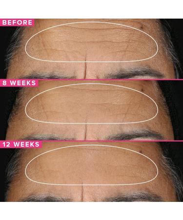 Farmacy Filling Good and Retinol Bundle - Hyaluronic Acid Serum for Face & 1% Vitamin A Resurfacing Retinol Serum - Buy Online on GoSupps.com