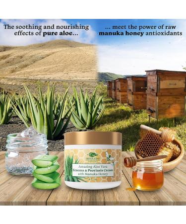 16oz Manuka Honey Eczema Cream for Psoriasis Relief - Soothing Moisturizer for Dry, Itchy Skin - Healing Ointment for Kids & Adults - Buy Online on GoSupps.com