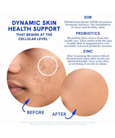 SMNutrition Clear Skin Acne Supplement Skin Support Vitamins for Women & Men - 120 Capsules - Buy Online on GoSupps.com