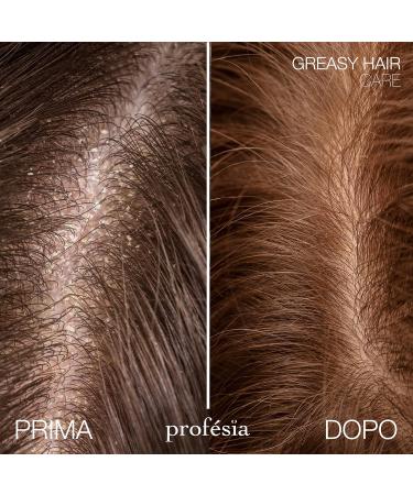  Profesia PROFESIA Shampoo for oily hair 1000 ml gentle shampoo professional rebalancing shampoo oily hair anti-sebum and anti-grease treatment sebum-regulating shampoo - Buy Online on GoSupps.com