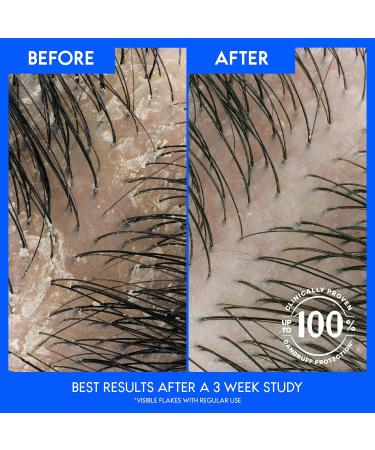 Head and Shoulders Men's 2 in 1 Dandruff Shampoo & Conditioner - Old Spice Pure Sport 20.7 oz | International Shipping Available - Buy Online on GoSupps.com