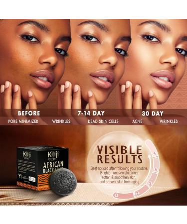 Koji White African Black Soap Bar - Exfoliating & Brightening Face & Body Wash with Shea Butter Kojic Acid & Aloe Vera - Vegan & Paraben-Free (2 Bars - Buy Online on GoSupps.com