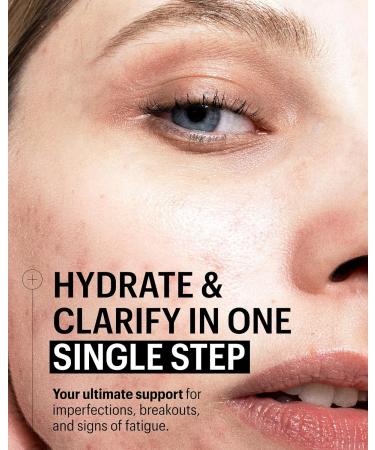 Allies of Skin Multi Nutrient & Dioic Renewing Face Cream | Balance and Hydrate Acne Prone Skin with Kombucha & Probiotics | Calm Redness Breakouts and Even Skin Tone | 1.7 fl oz - Buy Online on GoSupps.com