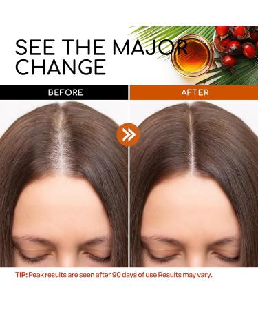 100% Pure Batana Oil for Hair Growth - Raw Unrefined Cold Pressed - Dr. Sebi's Natural Oil from Honduras - Buy Online on GoSupps.com