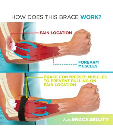 BraceAbility Epicondylitis Brace - Arm Compression Support Band for Medial/Lateral Epicondyle Pain & Tendonitis - Unisex (One Size) - Buy Online on GoSupps.com