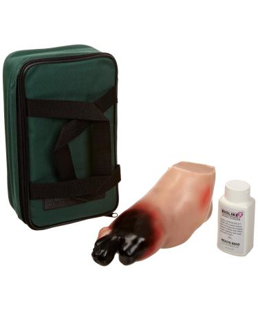 HEALTH EDCO W43107A Biolike Severe Diabetic Foot Model