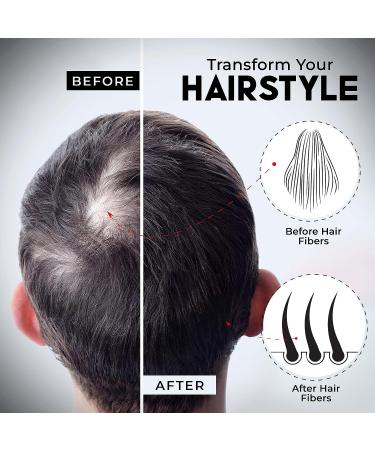 ELEVATE Hair Fibers for Thinning Hair - Dark Brown 40g Bottle - 100% Natural Keratin Fibers for Instant Balding Hair Loss Concealment - Men & Women - Buy Online on GoSupps.com