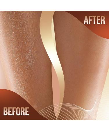 Exfoliating Glove Set with Body Scrub Brush - Dead Skin Remover | UK Seller - Buy Online on GoSupps.com