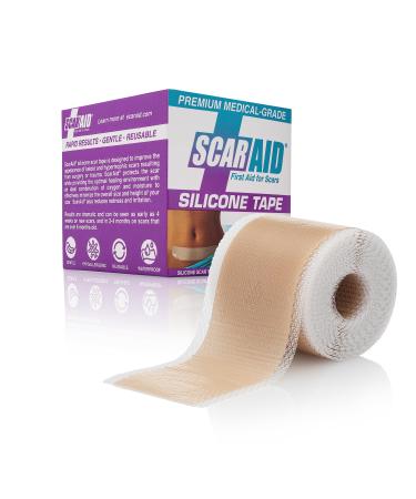 Silicone Scar Tape  Tummy Tuck Post Surgery Supplies and Bariatric Surgery Must Haves  Superior to Vitamin E Oil for Scars  Send your Scar Away  1 Roll 1.5 x 120