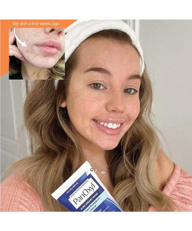 Panoxyl 4% Benzoyl Peroxide Pack of 2 Bundle - Buy Online on GoSupps.com