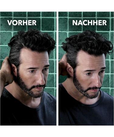  Schauma Schauma Intensive Anti-Dandruff Shampoo (400 ml) shampoo fights severe dandruff from the first application shampoo helps with itchy scalp - Buy Online on GoSupps.com