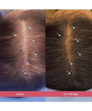 Spectral.CSF Leave In Serum for Thinning Hair in Women | DS Laboratories | Promotes Hair Growth, Thicker & Fuller Hair | 60ml (2 fl oz) - Buy Online on GoSupps.com