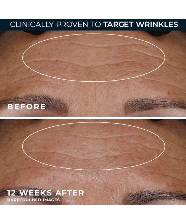 RoC Retinol Correxion Deep Wrinkle Night Cream - 1 oz | Anti-Aging Skin Care - Buy Online on GoSupps.com