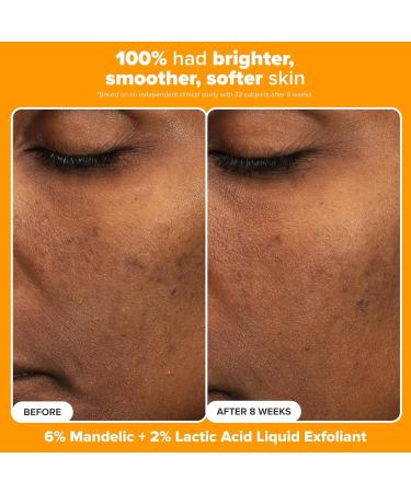 Paula's Choice Brighter Days Ahead Kit Vitamin C and AHA Trio Includes Travel Size C5 SPF Face Sunscreen Mandelic Acid Exfoliant C15 Vitamin C Booster Serum Brightening & Resurfacing 3-Piece Set - Buy Online on GoSupps.com