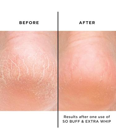 butter LONDON So Buff Hand and Foot Polish with Glycolic Acid Gently Exfoliates to Remove Dead Skin Antioxidant-Rich Ingredients Cruelty Paraben & Mineral Oil Free - Buy Online on GoSupps.com